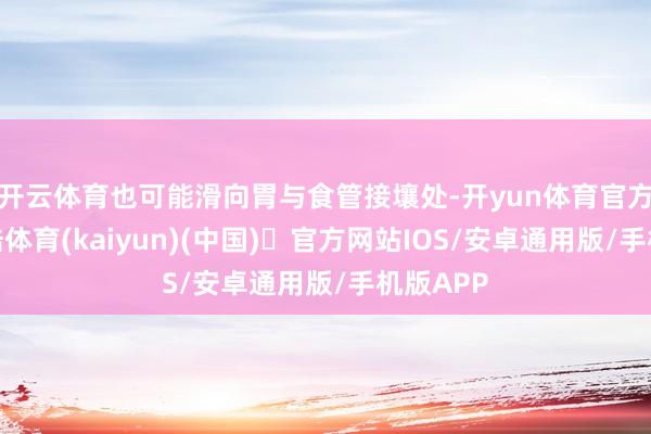 开云体育也可能滑向胃与食管接壤处-开yun体育官方网站登陆体育(kaiyun)(中国)❥官方网站IOS/安卓通用版/手机版APP